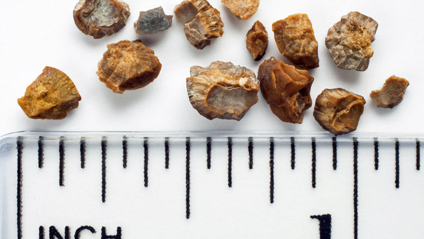 Picture of kidney stones next to a ruler